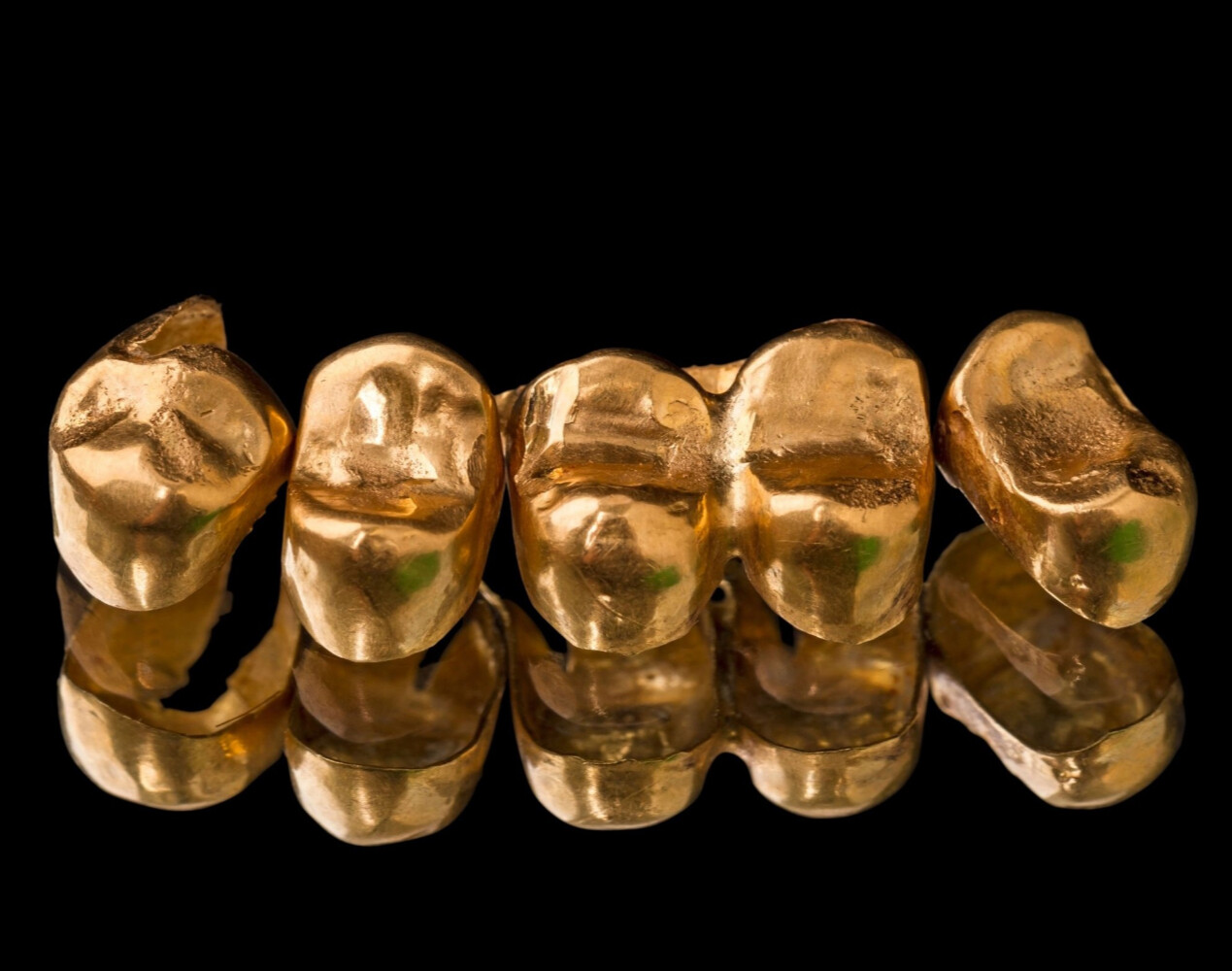 Скупка  стоматологического золота в Ростове-на-Дону